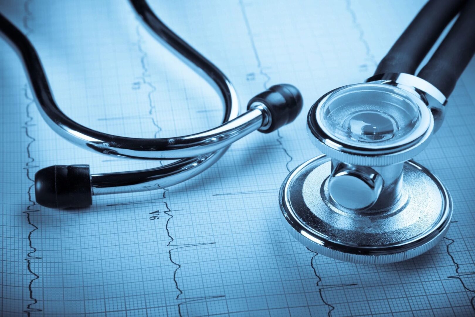A stethoscope on a paper with a heart rate graph.